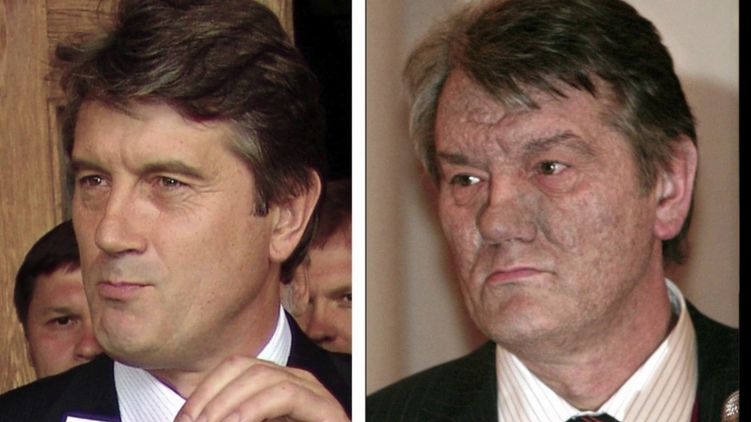 Отравление Ющенко - было ли оно на самом деле и как повлияло на Украину